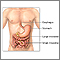 Inflammatory bowel disease - series