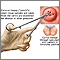 Biopsia cervical