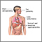 CMV (cytomegalovirus)