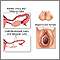 Primary amenorrhea