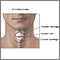 Emergency airway puncture