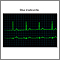 Bradycardia