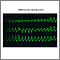 Ventricular tachycardia