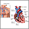 Swan Ganz catheterization