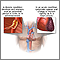 Acute vs. chronic conditions