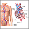 Left heart catheterization