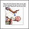 Heimlich maneuver on infant