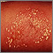 Pustules, superficial on the arm