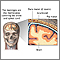 Meninges of the brain