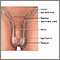 Testicular torsion repair - series