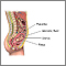 Amniocentesis - series