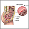 Chorionic villus sampling - series