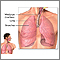 Lower respiratory tract