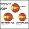 Normal, near, and farsightedness