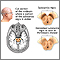 Substantia nigra and Parkinson's disease