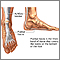 Plantar fascia