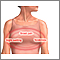 Breast pain