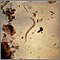 Hookworm rhabditiform larva