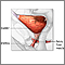 Bladder and urethral repair - series