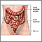 Colostomy - series