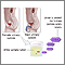 Aminoaciduria urine test