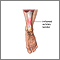 Inflammed achilles tendon