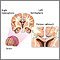 Corpus callosum of the brain