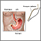 Esophageal manometry