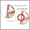 Lateral collateral ligament pain