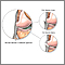 Lateral collateral ligament injury