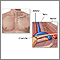 Thoracic outlet anatomy