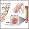 Antibody titer