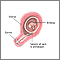 Chorionic villus sampling