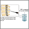 CSF protein test