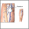 Doppler ultrasonography of an extremity