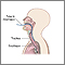 Esophageal pH monitoring