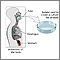 Culture of gastric tissue biopsy