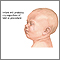 Infant test/procedure preparation