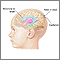 Intracranial pressure monitoring