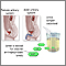 Leucine aminopeptidase urine test