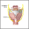 Laryngeal nerve damage