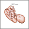 30 to 32 week fetus