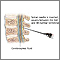 Lumbar puncture