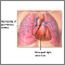 Primary pulmonary hypertension