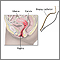 Endometrial biopsy