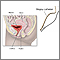 Ureteral biopsy