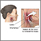 Oropharyngeal biopsy