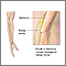 Radial nerve dysfunction