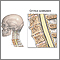 Cervical spondylosis