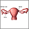 Uterine anatomy